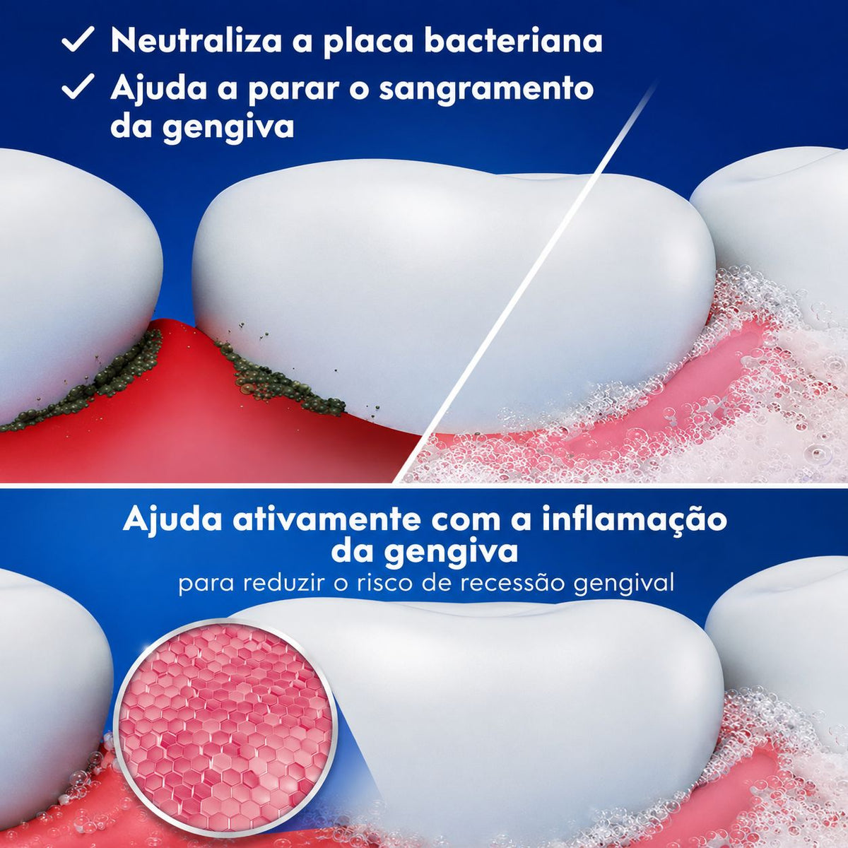 Crest Pro Santé Creme Dental Proteção Gengiva - Anticárie, Creme Dental com Fluoreto Antibacteriano